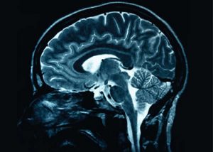 An image of a brain scan for CNS Pharmacology course